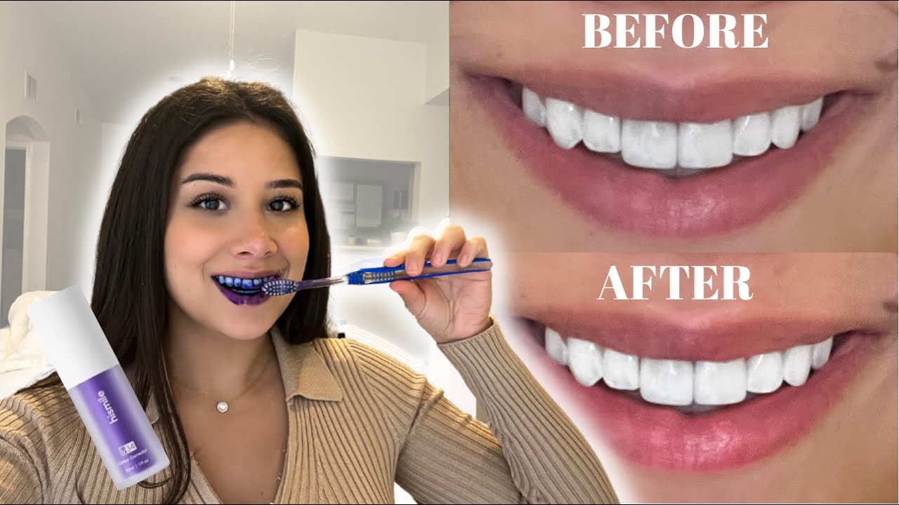 SMILEKIT ESPUMA MORADA BLANQUEADORA DENTAL (importada) 🇺🇸 😁💜