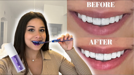 SMILEKIT ESPUMA MORADA BLANQUEADORA DENTAL (importada) 🇺🇸 😁💜