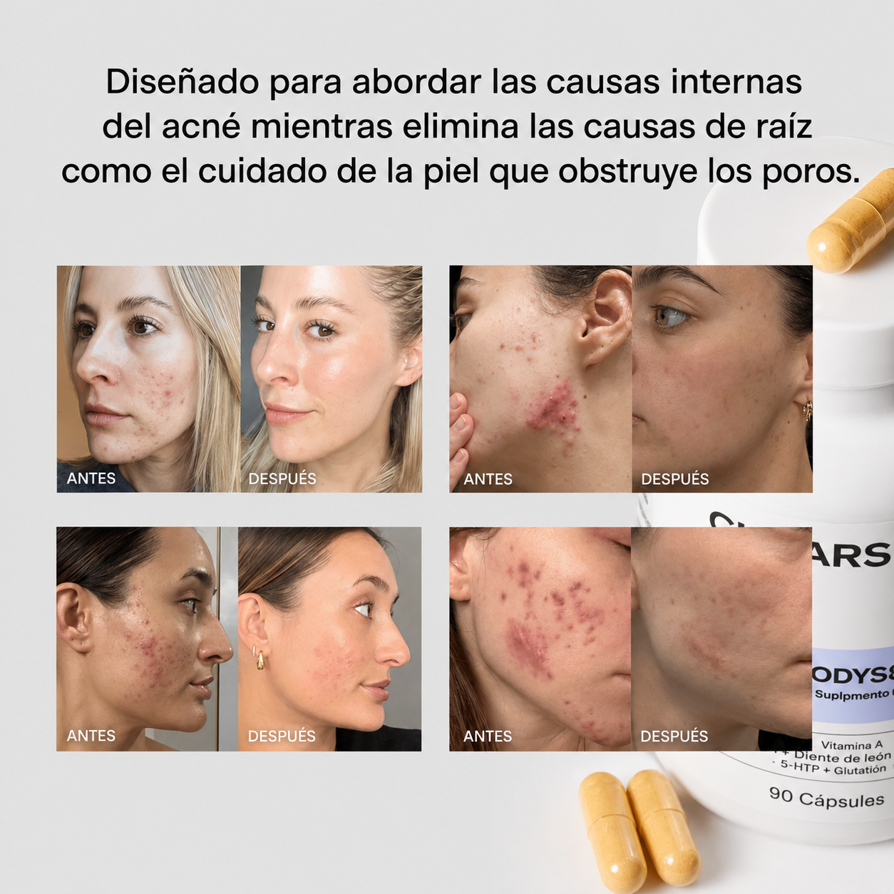 🌸 CLEARSTEM ACNÉ HORMONAL BAJO CONTROL, BELLEZA QUE SE NOTA 🌸 🇺🇸 100% ORIGINAL MADE IN USA ✅ | 🎁 OBSEQUIO SORPRESA | 🚚 ENVÍO GRATIS